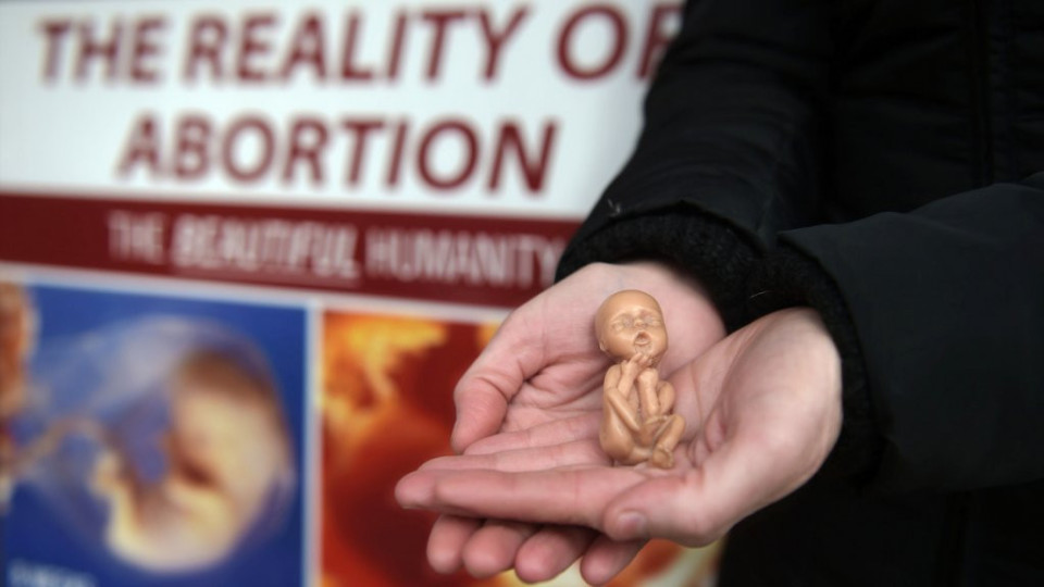 Тревожна статистика! Колко аборта се правят у нас | StandartNews.com