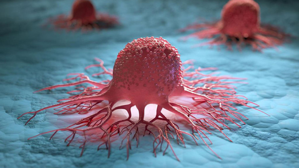 Как да уловим рака възможно най-рано | StandartNews.com