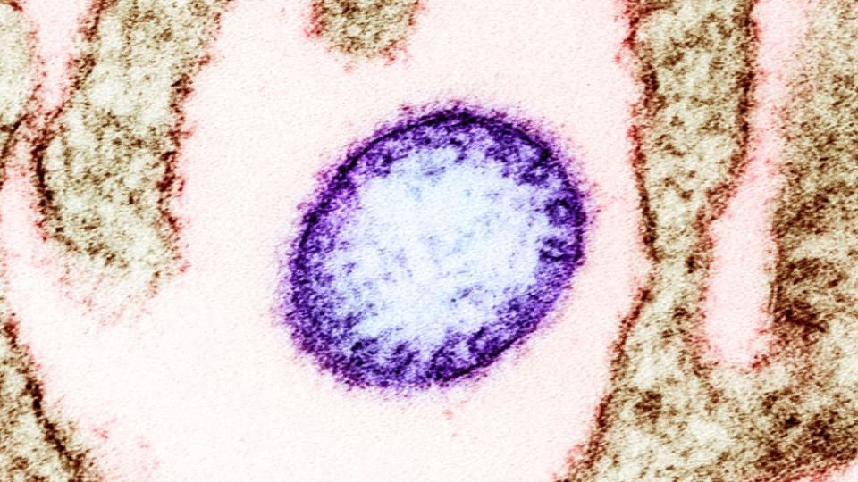 Нов опасен вирус тръгва от Китай, кога да го очакваме | StandartNews.com