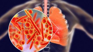 Нова зараза! Непозната пневмония убива
